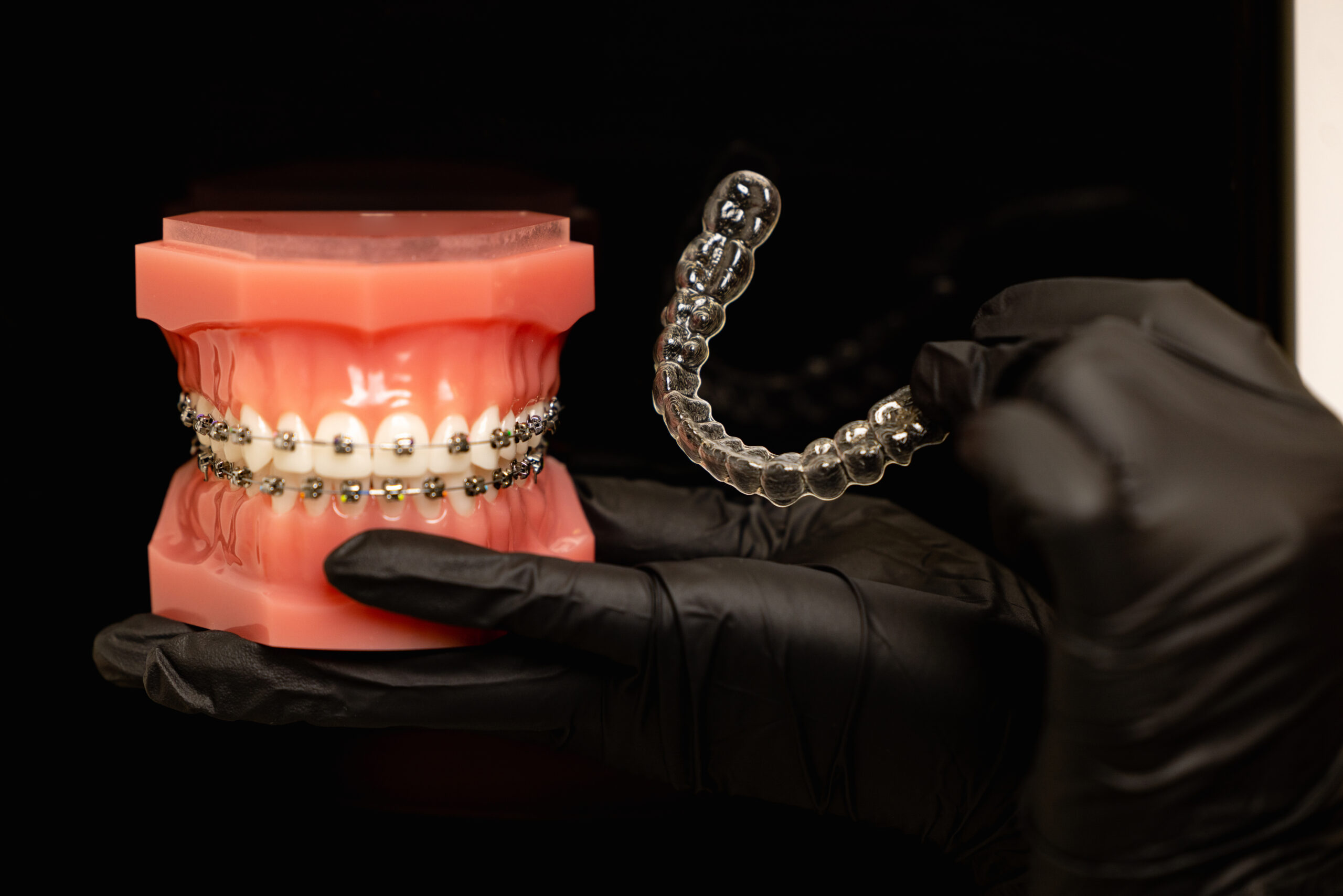 Sve o fiksnim ortodontskim aparatima – detaljan vodič