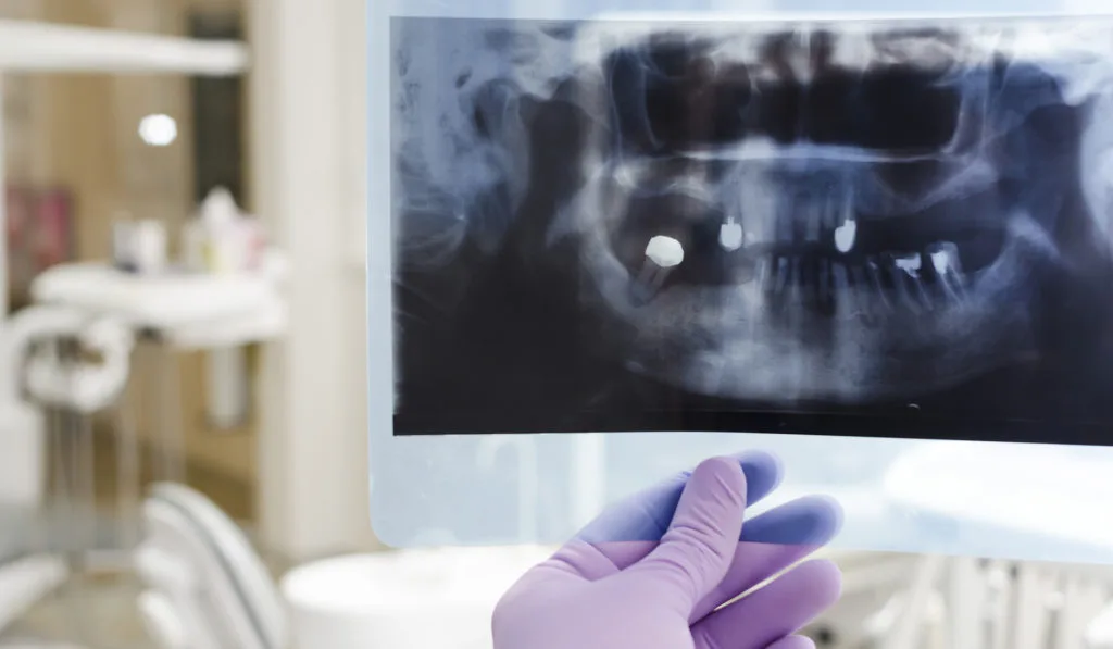 DSdent digitalni ortopan 1024x597 1