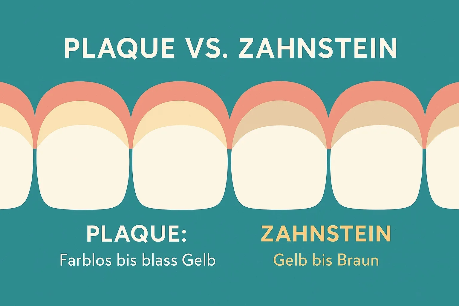 Ein flaches 2D-Zahn-Infografik, die sechs obere Frontzähne zeigt, wobei die linken Zähne eine helle Plaqueschicht und die rechten eine bräunlich-gelbe Zahnsteinablagerung aufweisen, vor einem türkisfarbenen Hintergrund – eine Darstellung, die den Unterschied zwischen Plaque und Zahnstein veranschaulicht.