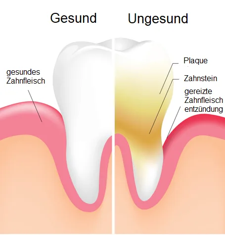 teeth22
